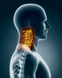 Acupunctura in cazul unei hernie a coloanei vertebrale