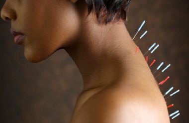 Akupunktúra osteochondrosis kezelés hatása
