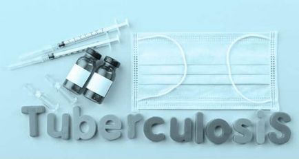 Tuberculoza infiltrativă - simptome și tratament