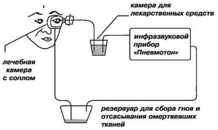 Використання інфразвуку в медицині - студопедія