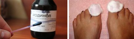 iodinol și ciuperca unghiilor de la picioare