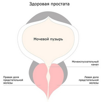 Як лікувати захворювання передміхурової залози