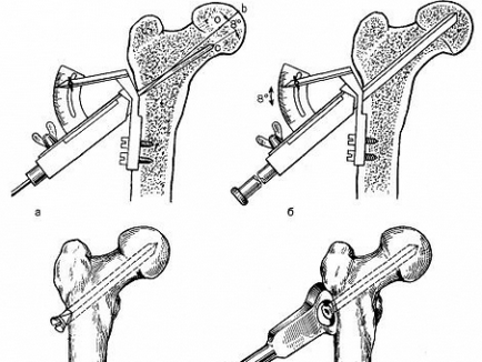 Care este cel mai mare os din corpul uman numit anatomie?