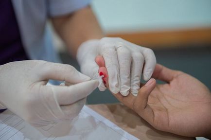 Hogyan lehet megállítani a HIV (HIV prevenció) Hogyan lehet megállítani a HIV