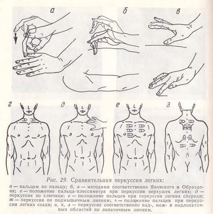 Cum se distinge bronșita de pneumonie, simptomatologie, diagnostic