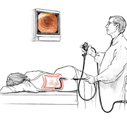 Cum se efectuează procedurile de diagnosticare în proctologie