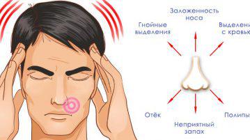 Cum să recunoașteți semnele sinusite, simptomele, catarla, tratamentul, adenoidele, inhalările, cauzele