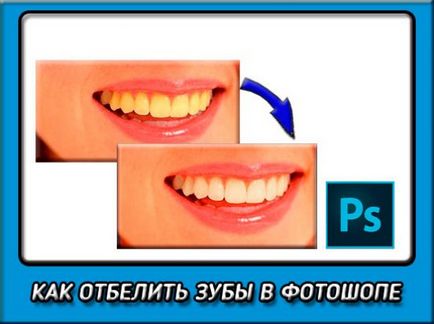 Як зробити зуби білішими в фотошопі і засяяти білосніжною посмішкою