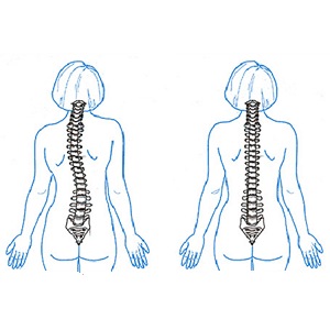 Cum să mențineți tineretul și flexibilitatea coloanei vertebrale