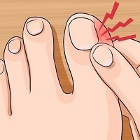 Cum să ai grijă de pantofi de piele de căt