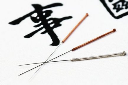 Acordați atenție sănătății dvs.! Cum functioneaza acupunctura