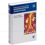 Комп'ютерна томографія прокоп cкачать безкоштовно або читати оналйн