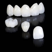 Коронки з металокераміки на передні зуби