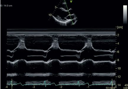 Cumpara dispozitive cu ultrasunete ge in moscow