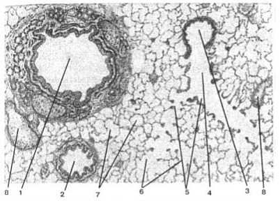 Plămânii sub microscop, pneumococi, macrofage alveolare