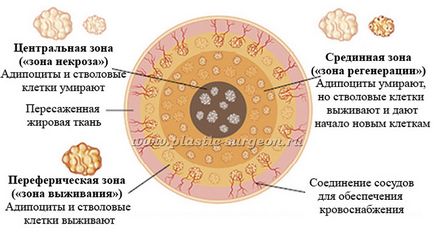 Levitskaya Mariya Grigoryevna, sarukhanov georgii mihailovich - ghid pentru lipofilling