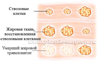 Maria G. Levitsky, Saruhanov Georgy - Útmutató lipofilinga