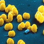 Febră de origine necunoscută cu boli infecțioase și neinfecțioase
