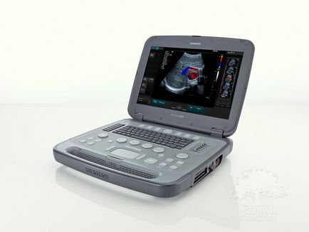 Medstore sathy analizează noua mașină portabilă cu ultrasunete siemens acuson p500