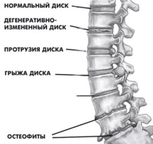 MRI a gerinc és a gerincvelő, docclinic