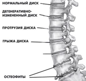 Мрт хребта і спинного мозку, docclinic