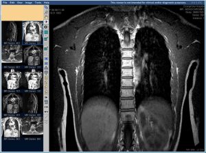 MRI a gerinc és a gerincvelő, docclinic