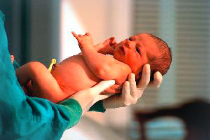 Недоношена дитина - дихання у недоношених, теплообмін, імунна і нервова система у