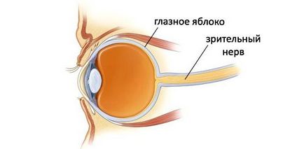 Nevrită optică - cauze, simptome și tratament, site-ul medical
