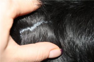 Nizoral sampon - készítmény, alkalmazás, ellenjavallatok, ár, fotók (összetétel) Nizoral sampon - készítmény, alkalmazás, ellenjavallatok, Ár, Fénykép