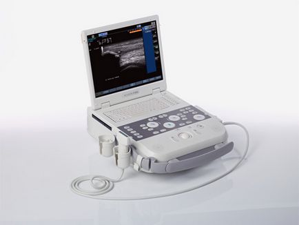 Scaner portabil nou cu ultrasunete
