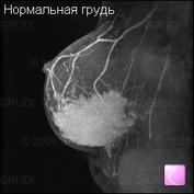 emlővizsgálat implantátumok - blog omorfia projekt