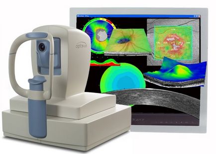 Оптична когерентна томографія