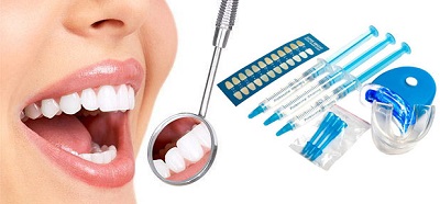 Відбілювання зубів white smile принцип дії, як відбувається процедура за допомогою системи вайт