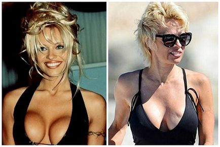 Pamela Anderson înainte și după operații plastice, fotografii și videoclipuri