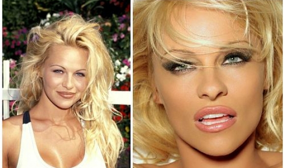 Pamela Anderson înainte și după operații plastice, fotografii și videoclipuri