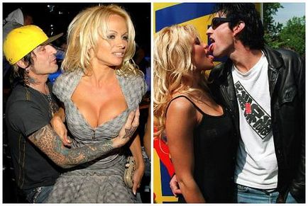 Pamela Anderson înainte și după operații plastice, fotografii și videoclipuri