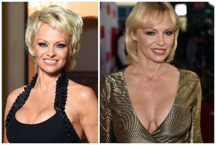 Pamela Anderson înainte și după operații plastice, fotografii și videoclipuri