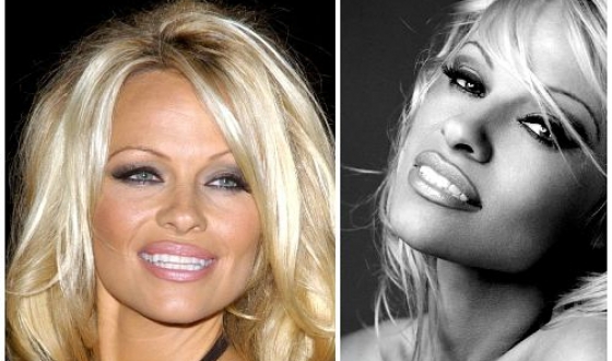 Pamela Anderson înainte și după operații plastice, fotografii și videoclipuri