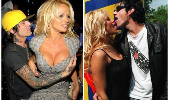 Pamela Anderson előtt és után plasztikai sebészet fotók és videó