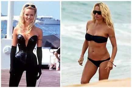 Pamela Anderson înainte și după operații plastice, fotografii și videoclipuri