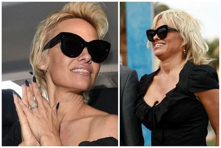 Pamela Anderson înainte și după operații plastice, fotografii și videoclipuri