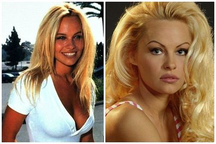 Pamela Anderson înainte și după operații plastice, fotografii și videoclipuri