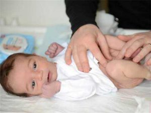 Hernia inghinala intr-o operatie si cauza a copilului
