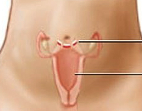 Ligarea trompelor uterine plus și minusurile de funcționare, argumente pro și contra