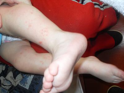 Чому у дитини болять ноги ночами