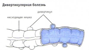 Користь і шкода білків