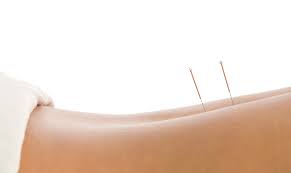 Are acupunctura ajuta cu dureri de spate?