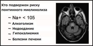 Понтінья міеліноліз причини розвитку захворювання, основні симптоми і методи лікування