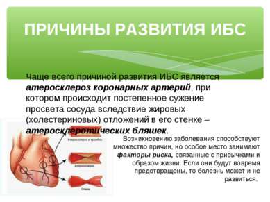 Представяне - превенция на сърдечно-съдови заболявания - свободно изтегляне