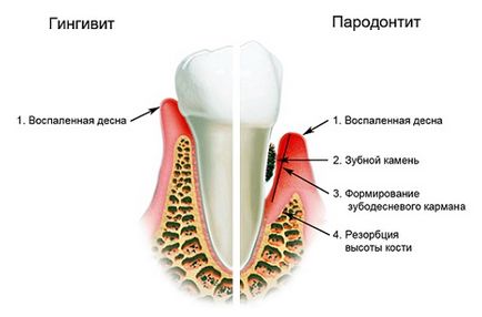 При кашлі неприємний запах про що це говорить і як усунути